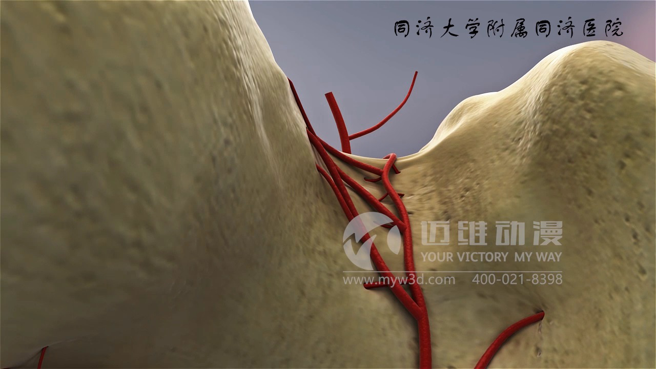 醫學(xué)仿真三維動(dòng)畫(huà)演示