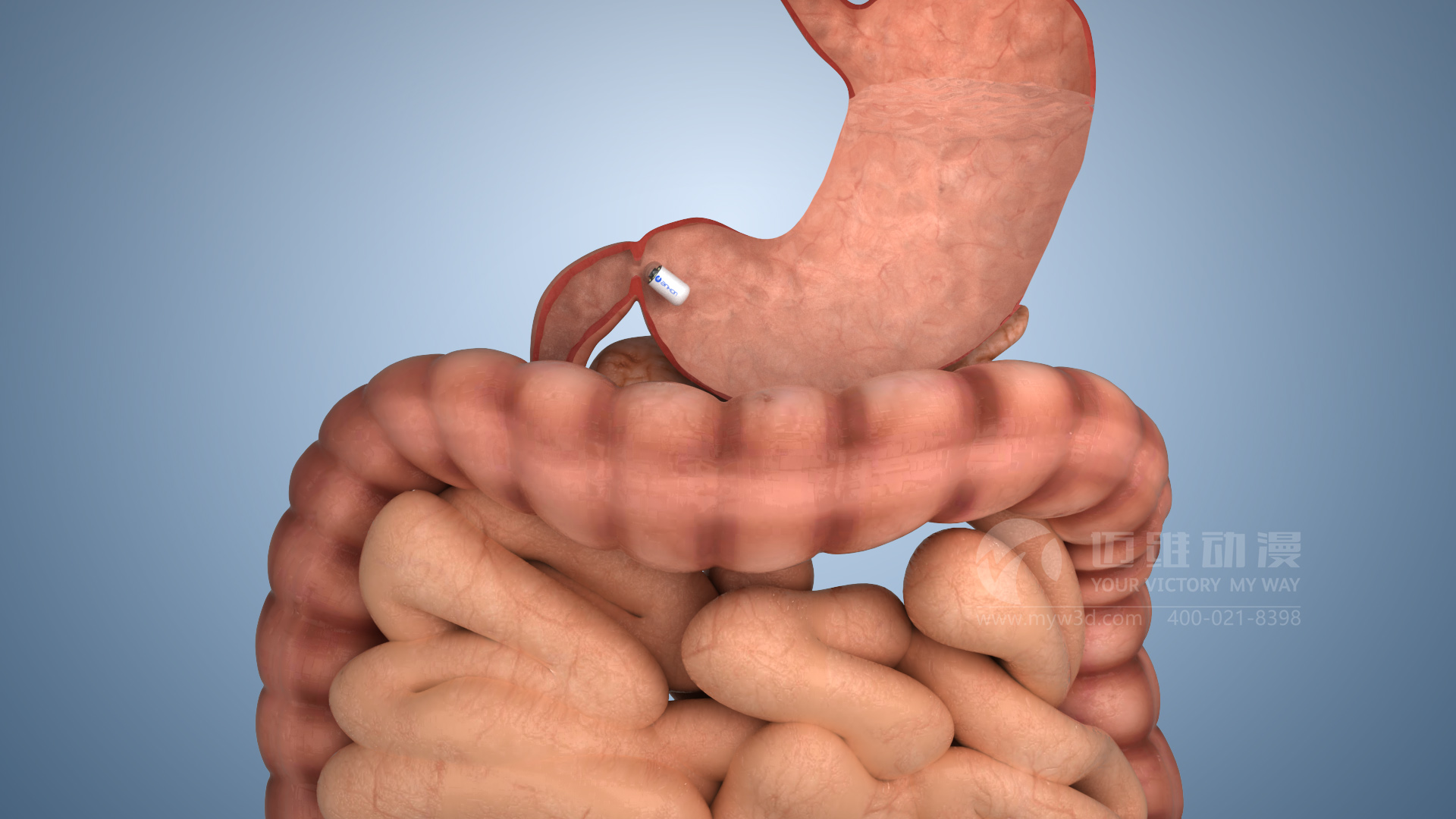 膠囊機器人動(dòng)畫(huà).jpg 膠囊機器人動(dòng)畫(huà).jpg