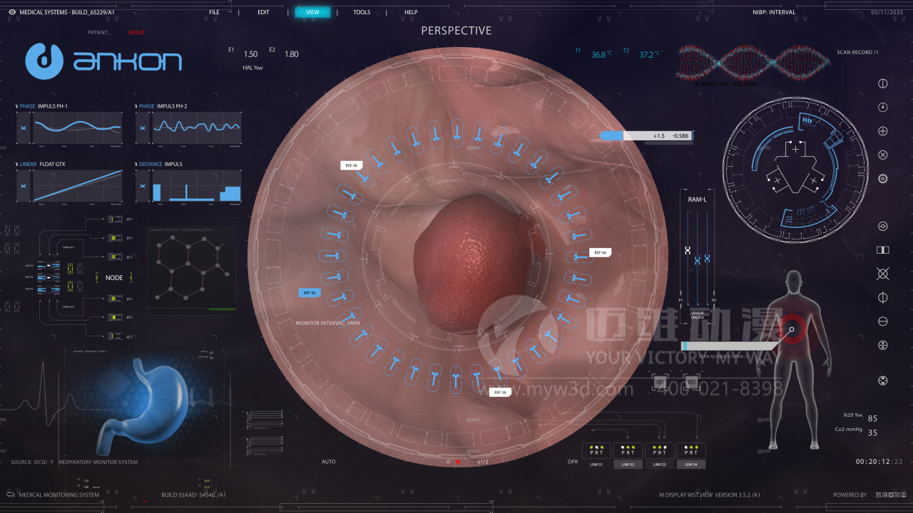 醫學(xué)醫療三維動(dòng)畫(huà).jpg 醫學(xué)醫療三維動(dòng)畫(huà).jpg