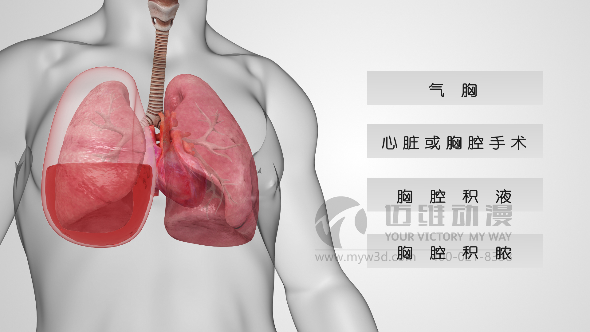 醫療器械動(dòng)畫(huà).jpg