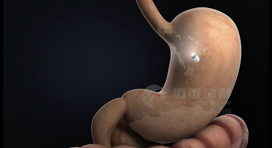 醫用設備三維動(dòng)畫(huà)制作好處有哪些？(圖1)